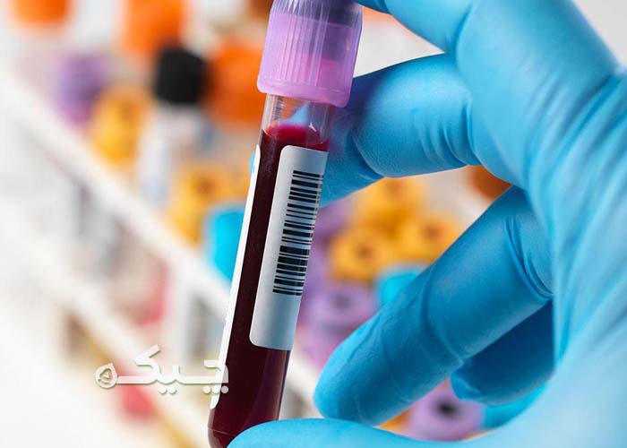 نمونه‌گیری و آزمایش در محل
